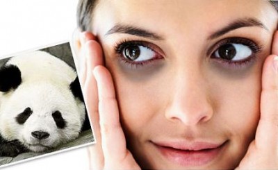 trị thâm quầng mắt và bọng mắt 4