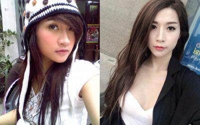 5 hot girl Việt công khai phẫu thuật thẩm mỹ
