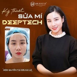 Cắt mắt bị hỏng